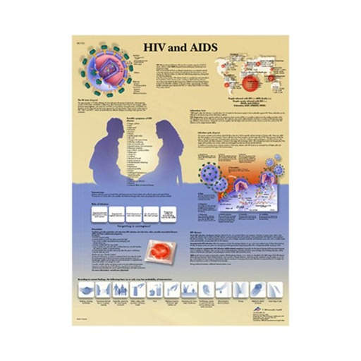 [VR1725L] Laminated HIV and AIDS Chart